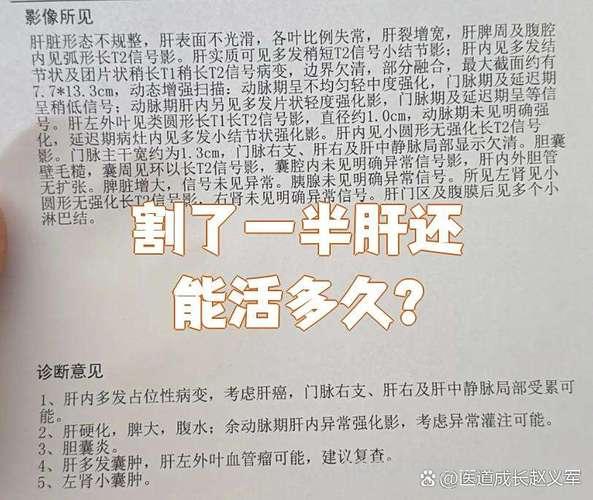 肝癌手术切除后也不可掉以轻心