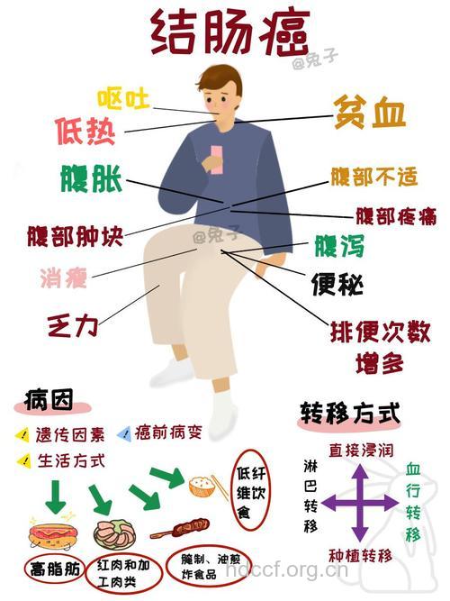 大肠癌患者要知道的二十个常识