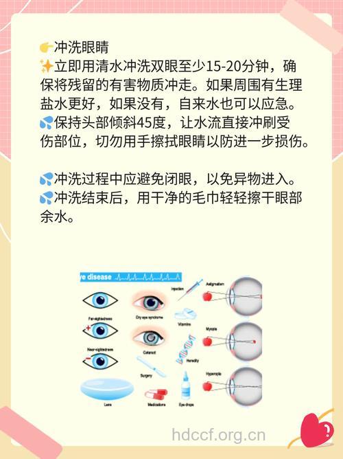 电焊光伤眼急救处理方法
