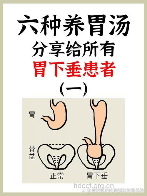 中医外治胃下垂