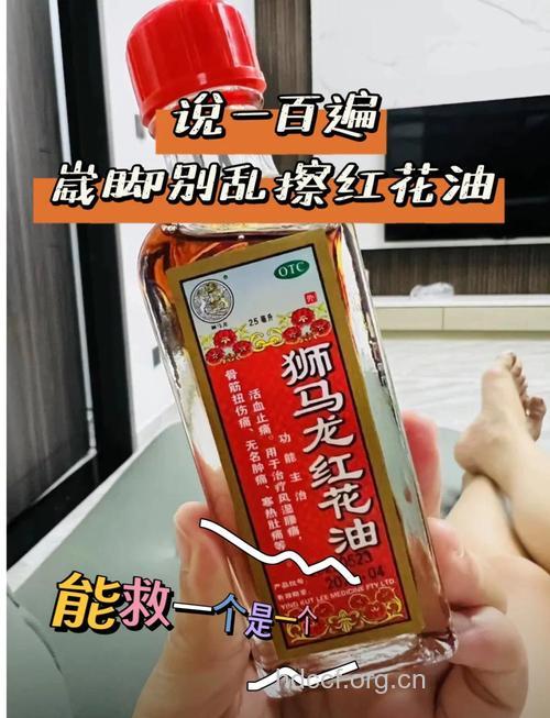 扭伤千万别立刻抹红花油