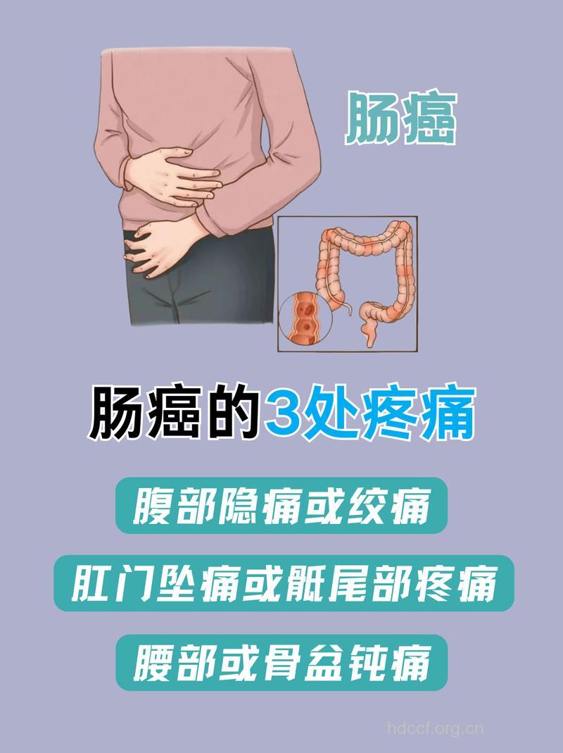 警惕!这样易患大肠癌