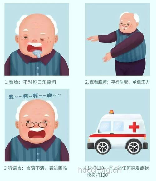 脑中风急救法则