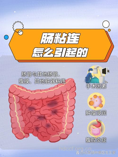 中医教你认识肠粘连