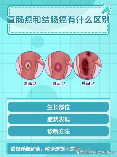 分辨直肠癌与其他疾病的区别