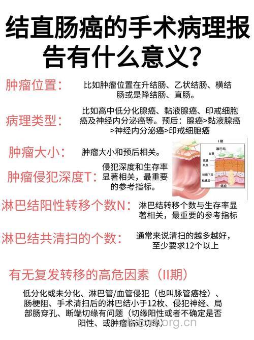 一则结肠癌病案的解析