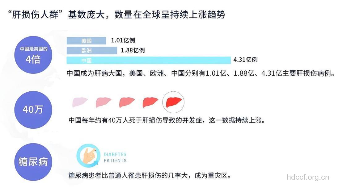 美研究:基因导致男性更易患肝癌