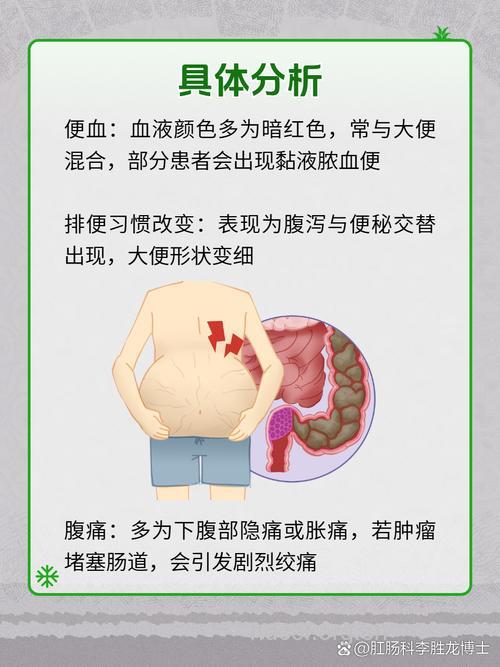 直肠癌常见的临床表现