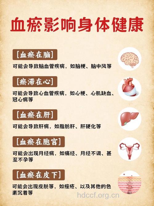 心血管疾病发病根源：气虚血淤