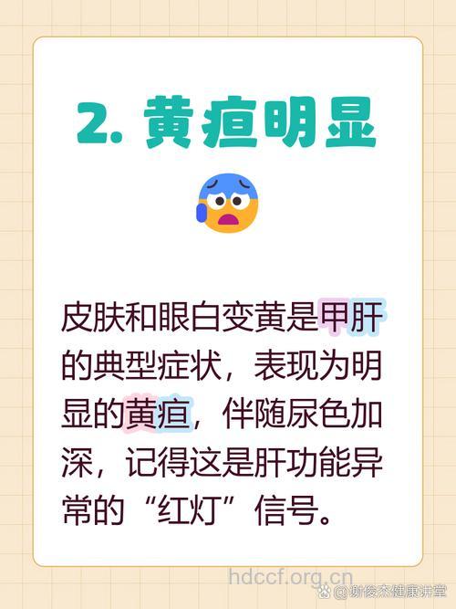 甲肝常见的症状有哪些
