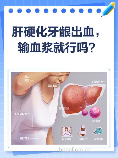 肝癌出血的治疗原则