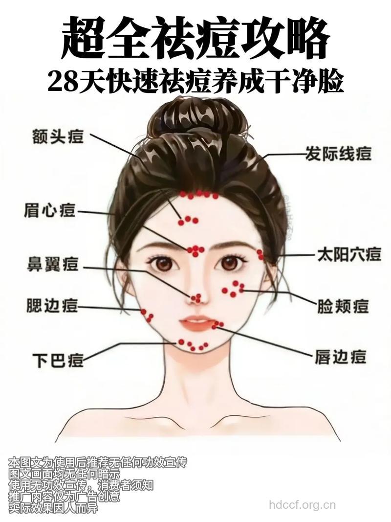 青春期总长痘怎么办 用这几招痘痘再也不长了