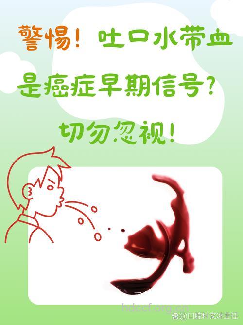 漱口血流不止元凶是肝癌