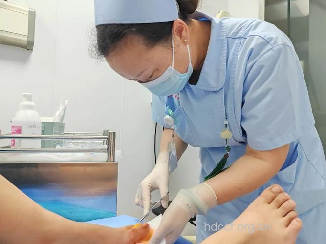 甲型肝炎中西医治疗