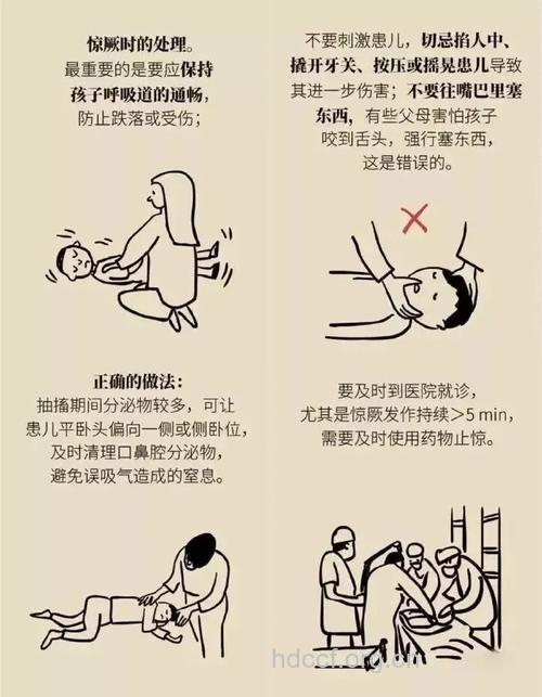 小儿惊厥急救法