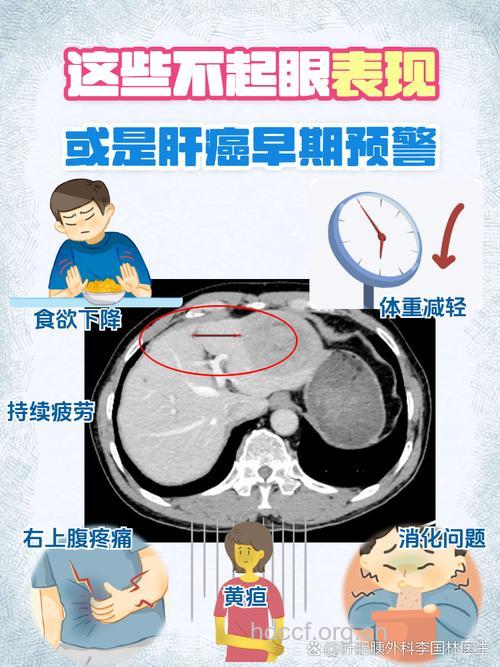 老年人肝癌常见的并发症