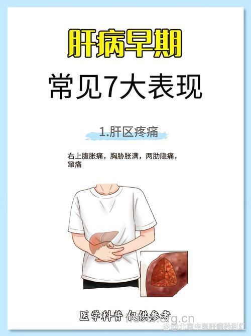 肝癌早期症状是如何表现的