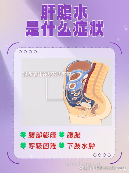 肝癌患者出现腹水现象怎么办
