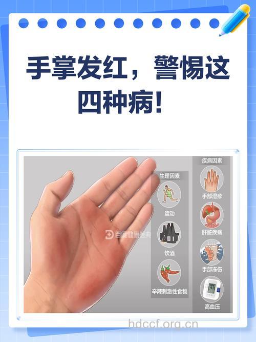 手掌出现这些信号 可能是肾虚在“搞鬼”