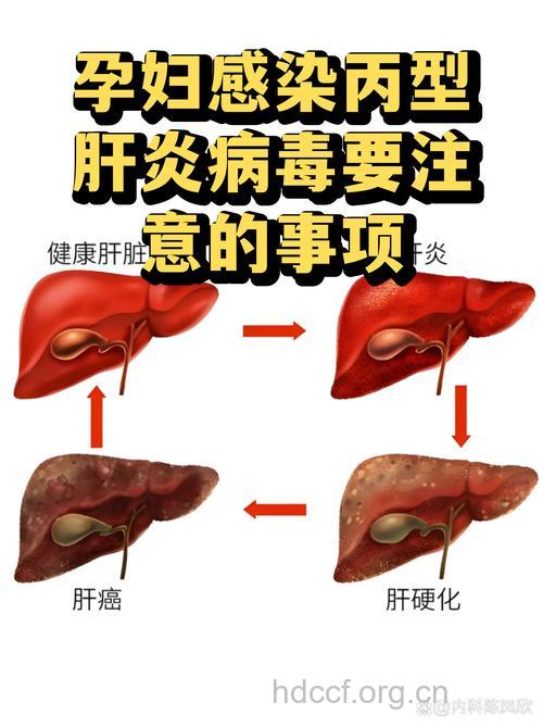 怀孕后感染丙肝该怎么办