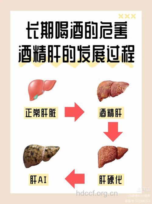 喝酒到底会不会导致肝癌