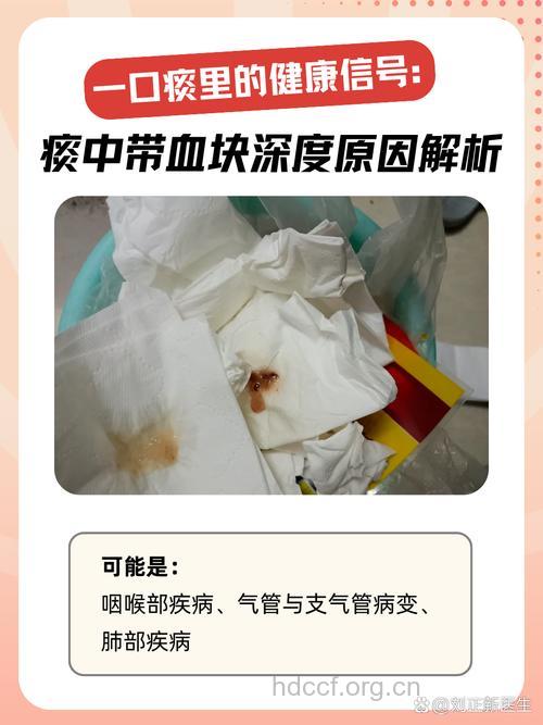 吐血痰的原因都有哪些