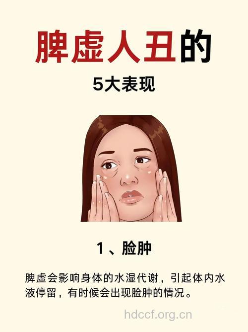 面部4个表现提醒你脾虚