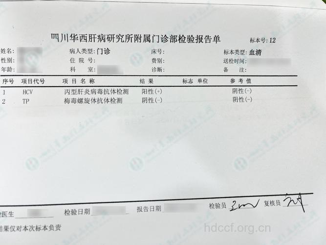 诊断丙肝要做肝功能检查吗