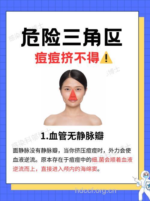 脸部“危险三角”真的危险