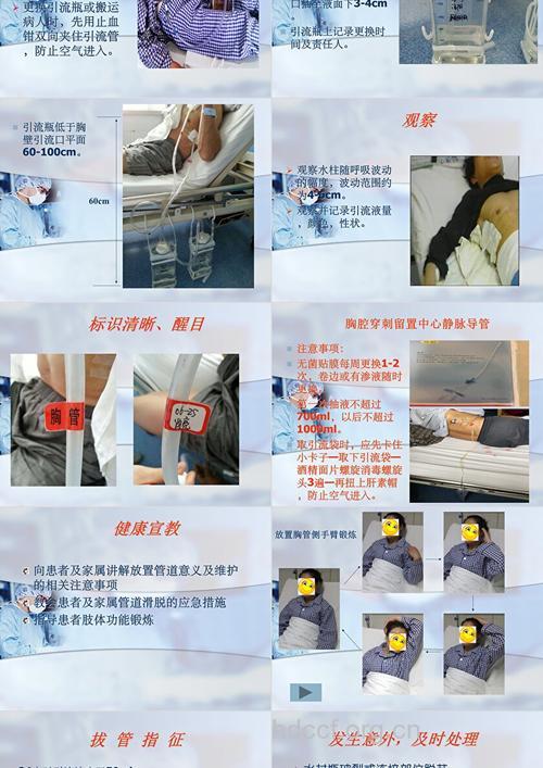 重症胸外伤的护理措施