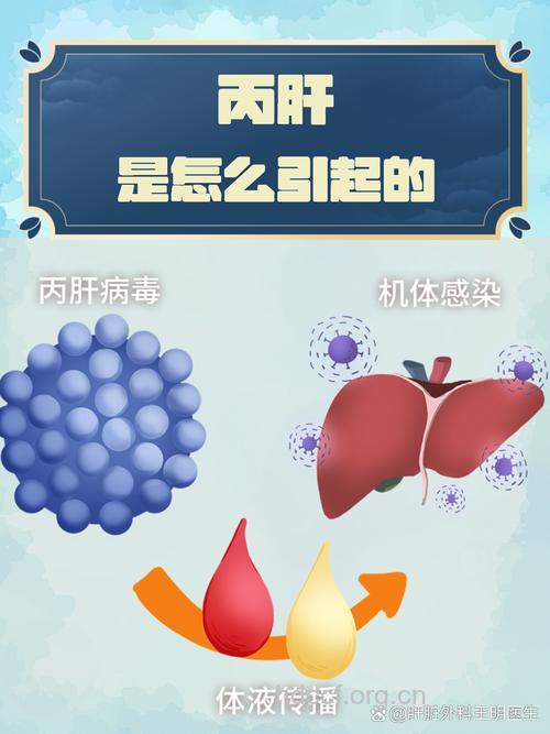 诱发丙肝的主要原因