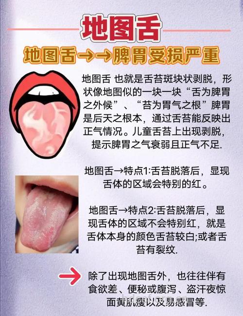 怎么根据舌头变化饮食调节