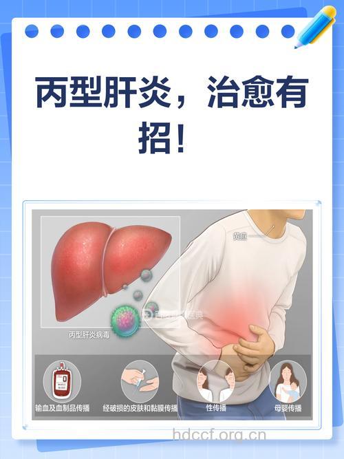 丙型病毒性肝炎可以治愈吗