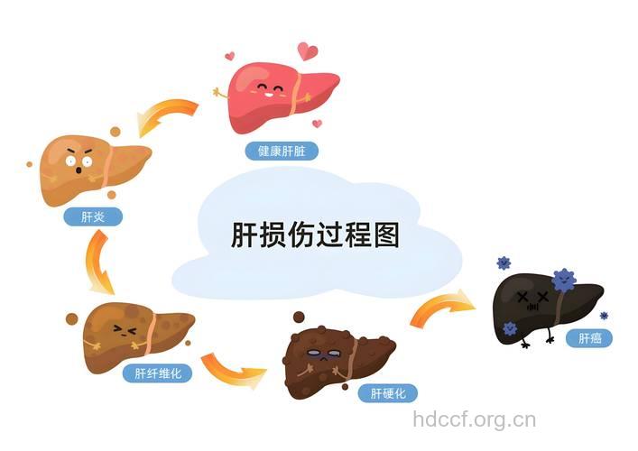 肝癌病因是哪些