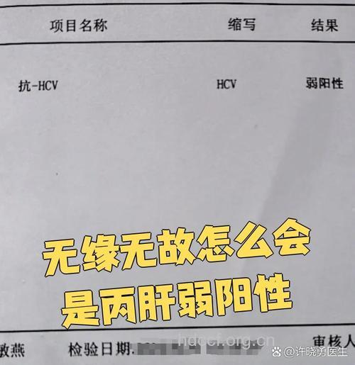 丙肝抗体阳性是会传染吗