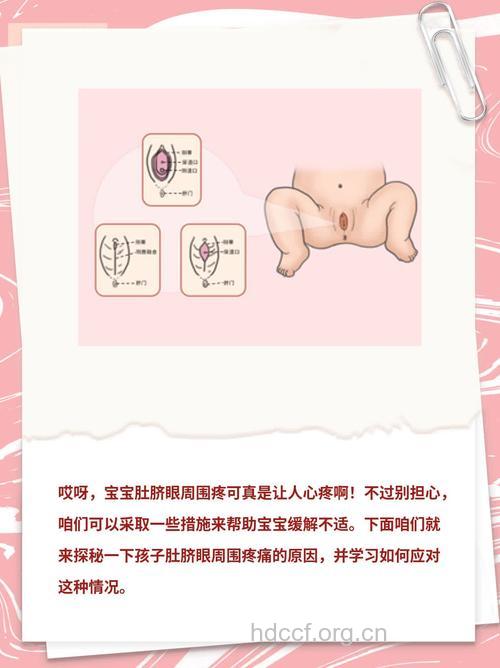 小儿突然脐周疼痛的处理方法