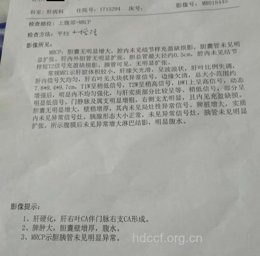 肝癌的诊断依据是什么呢