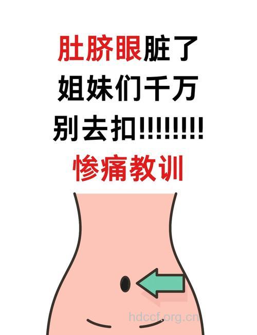 肚脐眼脏怎么清理 不能硬抠