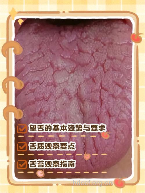 中医望舌有讲究 4类食物绝不能吃