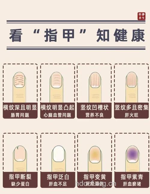 指甲盖纹路大不同 哪种最健康