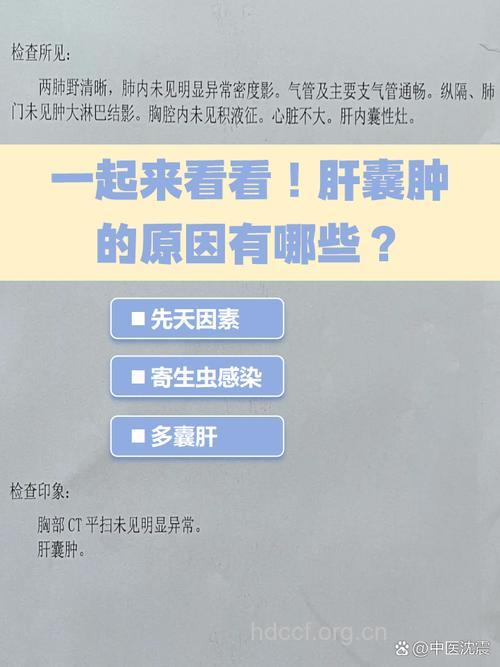 诱发肝囊肿的4大病因不得不知