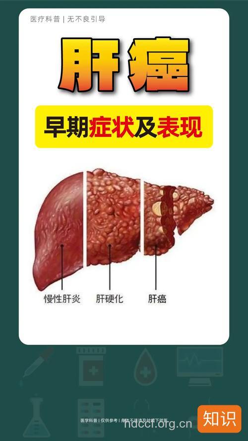 肝癌在早期较主要的表现是什么