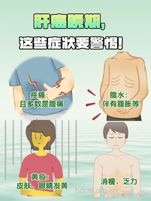肝癌不同位置晚期症状有哪些