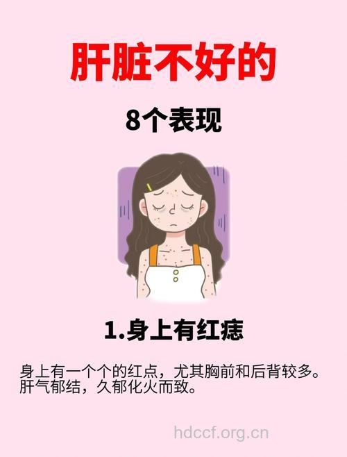 女性肝癌有哪些早期症状