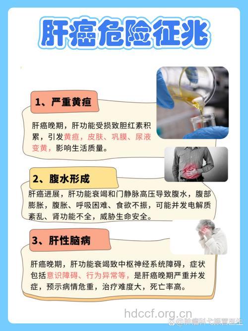 肝癌介入治疗的适应症有哪些