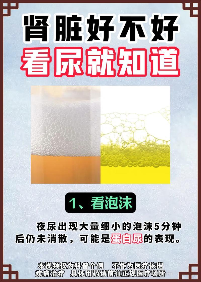 想知道肾脏健康看看自己的尿液