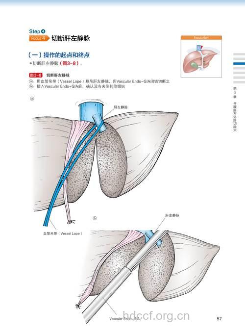 哪些手术方法可治疗肝癌