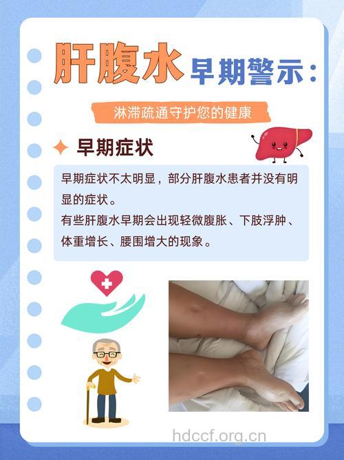 肝腹水早晚期的症状有哪些