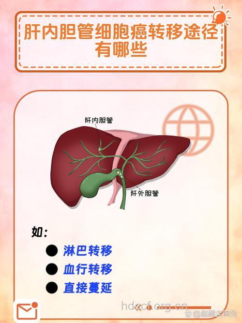 肝癌的转移途径是什么呢