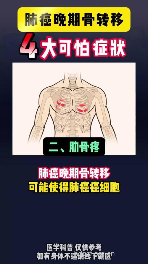 肝癌转移到骨骼的症状是什么